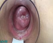 Japanese Milf Cervix Fucking with German real penis dildo and asian chopsticks from hindi me penis uterus mri u