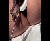 Tenaculum forceps cervical penetration from cervical exam of chubby young blonde cayla lyons by 2 doctors
