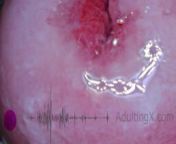 Cervix Pulse Heartbeat Orgasms EKG - Sophie Adulting from riti riwaj tijarat