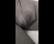 Swollen genitalia in tight suit from pronounce